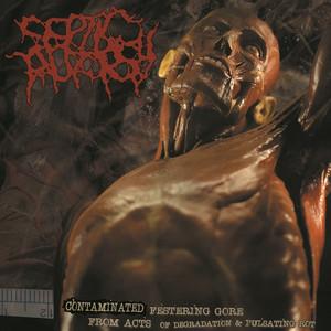 Septic Autopsy - Contaminated Festering Gore From Acts Of Degradation & Pulsating Rot (2021)